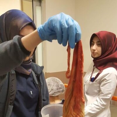 Ameliyattan sonra ağrıları geçmeyince korkunç gerçek ortaya çıktı!