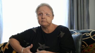 Et yiyen bakteri hayatını altüst etti!