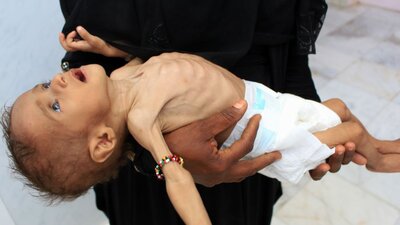 Yemen krizi: '85 bin çocuk açlıktan öldü'