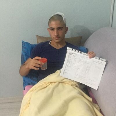 15 yaşındaki liselinin kafatasını parçaladılar