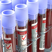 AIDS hakkında en çok merak edilenler!