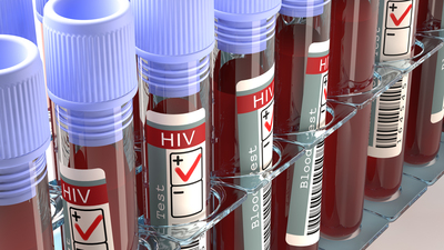 AIDS hakkında en çok merak edilenler!