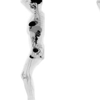 Tıpta çığır açacak görüntüleme cihazı!