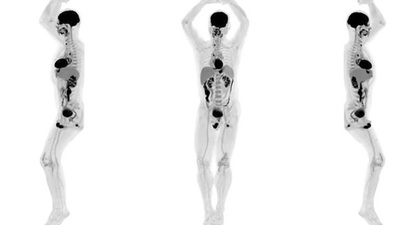 Tıpta çığır açacak görüntüleme cihazı!