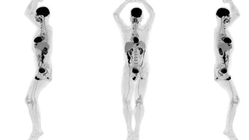 Tıpta çığır açacak görüntüleme cihazı!