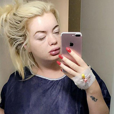 Loto milyonerinin değişimi dudak uçuklattı!