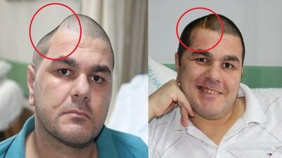 Görüntüsü sebebiyle dışarı bile çıkamıyordu! Şimdi ise...