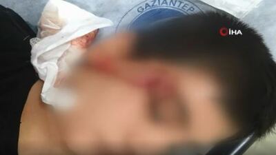 Dehşet anları kameraya da yansıdı! Pitbullun ağzından alamadılar!