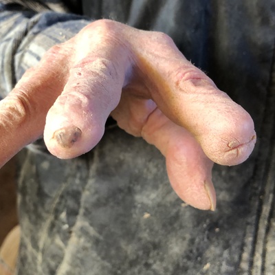 72 yıllık mesleği ellerini bu hale getirdi!