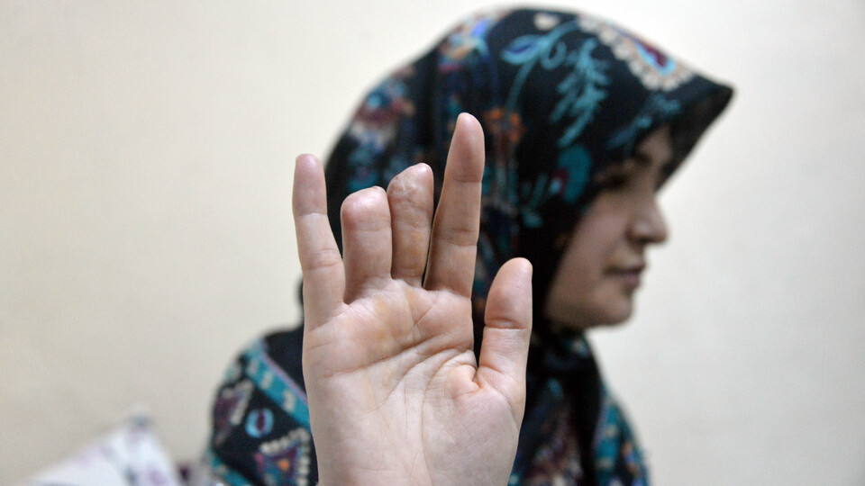 Kopan parmaklarının hastanede kaybolduğu iddiasıyla suç duyurusu!