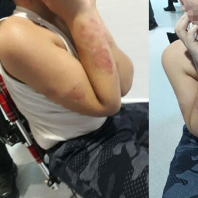 Engelli çocuğa akılalmaz işkence iddiası