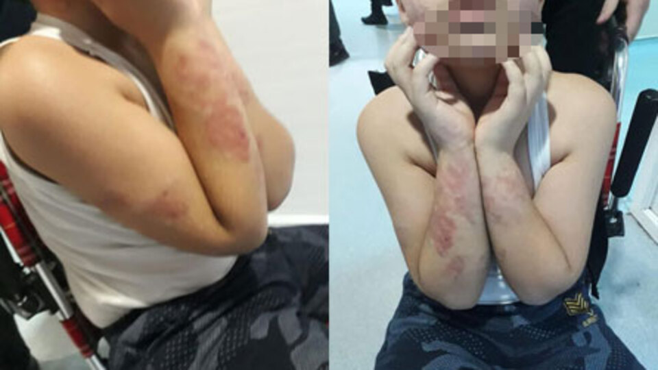 Engelli çocuğa akılalmaz işkence iddiası