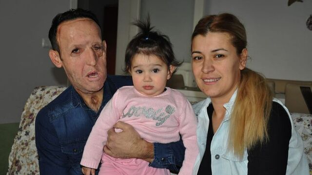 İşte yüz nakilli Recep Sert'in hastanedeki minik yardımcısı...