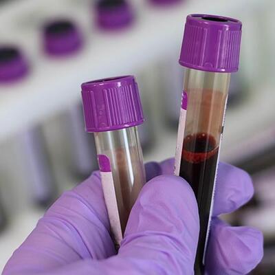 O hastalığı önlemede yüzde 100 başarı hedefi!