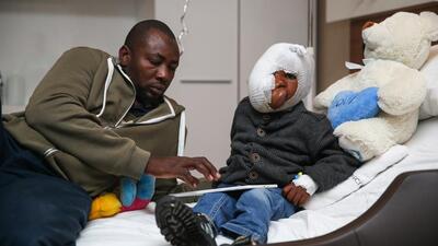 Yüzünün sağ tarafını kaplayan tümörle doğdu! 5 yıl böyle yaşadı ama...