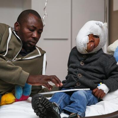 Yüzünün sağ tarafını kaplayan tümörle doğdu! 5 yıl böyle yaşadı ama...