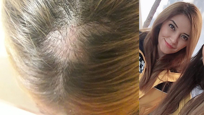 "Yaralarını sardığım eller beni bu hale getirdi"