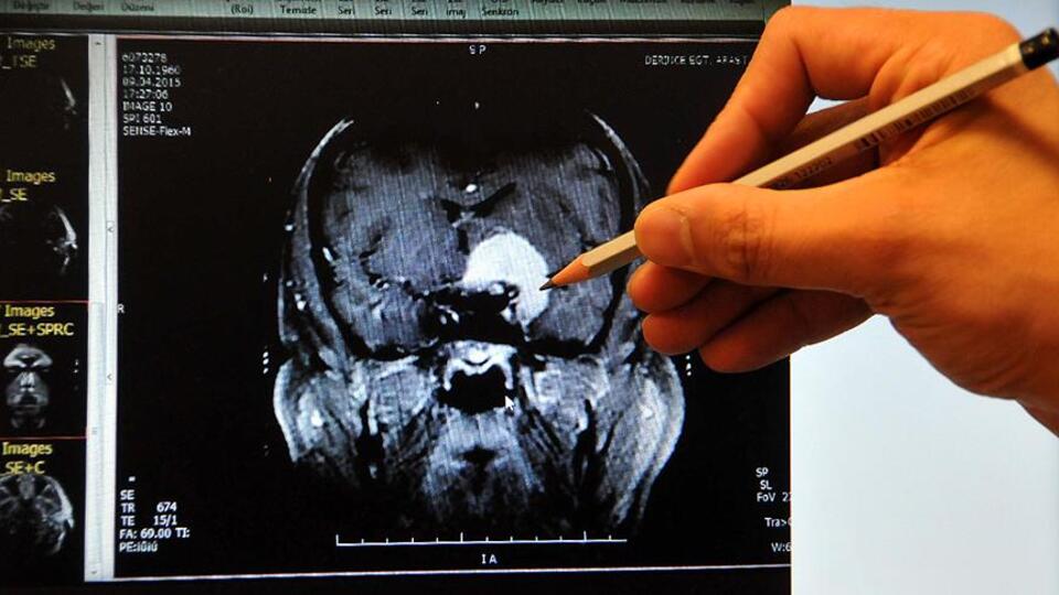 Dikkat! Belirti vermeden ilerliyor...