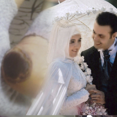 Genç kadının topukları bu hale gelmişti! Korkunç olayda flaş gelişme!