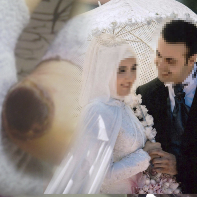 Genç kadının topukları bu hale gelmişti! Korkunç olayda flaş gelişme!