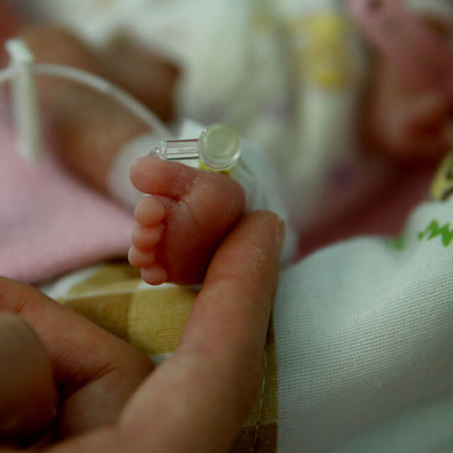 İyi sağlık hizmeti milyonlarca prematüre bebeği yaşatabilir