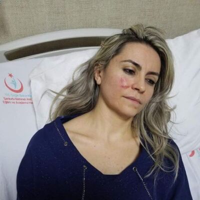 Şanlıurfa'da yaşandı! Doktora çürük raporu şiddeti!