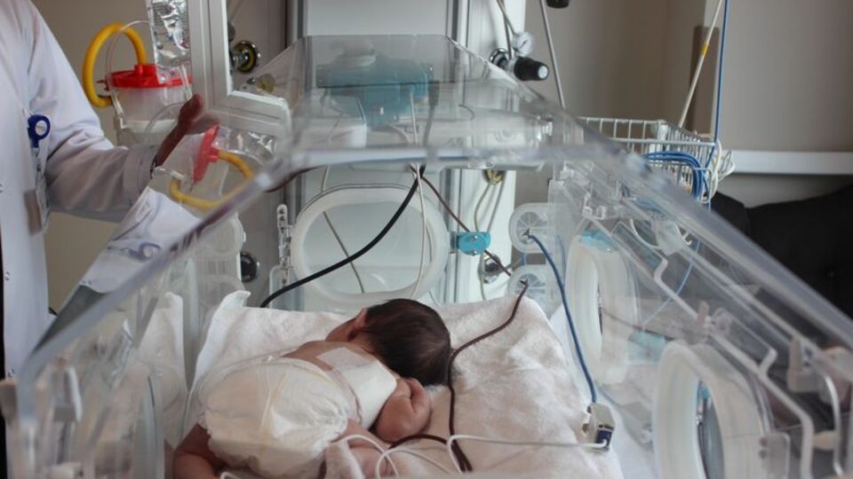 Yemek borusu olmadığı tespit edilen bebeğe yemek borusu yapıldı