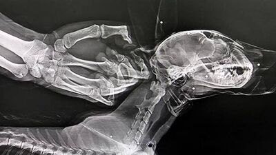 İşte avcıların marifeti! Tedavi altında