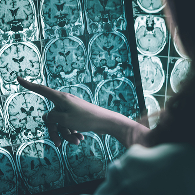 Türk doktorlar keşfetti! Yosundan...