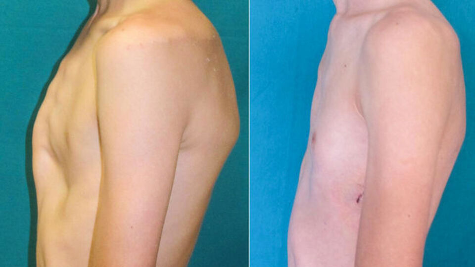 Tişört giyme hayali gerçek oldu