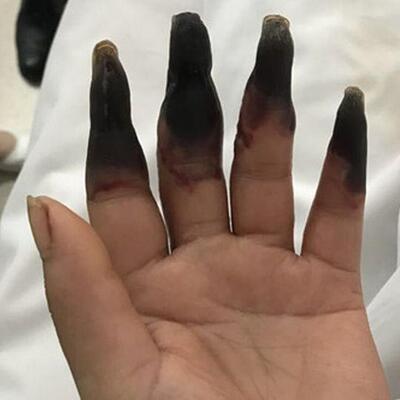 Küçücük bir kesik onu bu hale getirdi! Dikkat sizin de başınıza gelebilir!