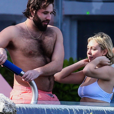 Kalçasındaki morluklar dikkat çekti