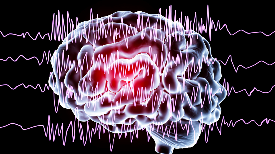 Epilepsiye "pilli" tedavi