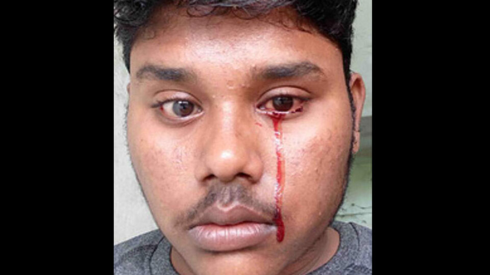 'Kan ağlıyor' deyimi gerçek oldu!