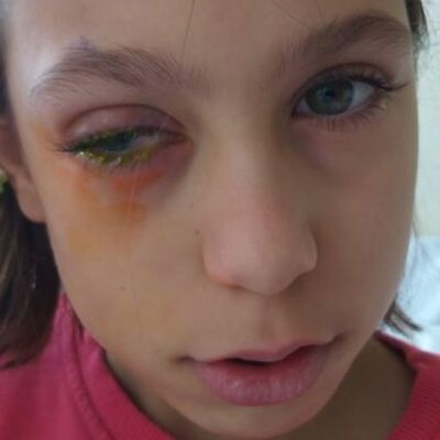 Poşeti açmak isterken bu hale geldi!