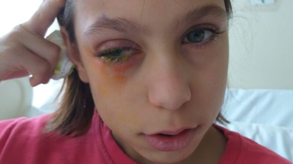 Poşeti açmak isterken bu hale geldi!