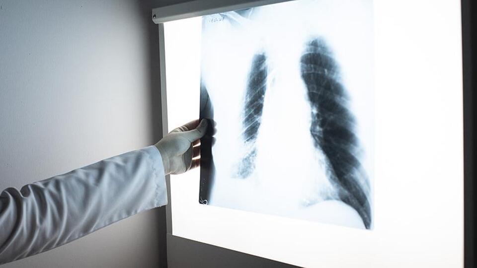 Uzun süren öksürüğe dikkat!