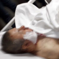 Madde bağımlısı, eşinin gözlerinin önünde görme engelliyi başından bıçakladı!