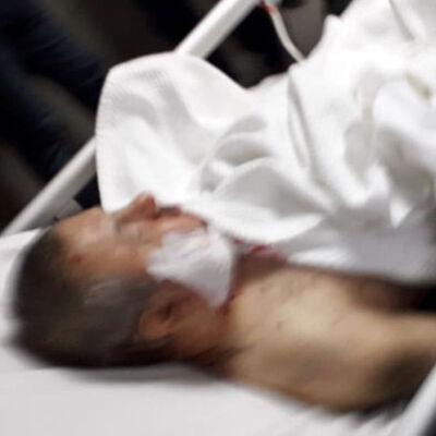 Madde bağımlısı, eşinin gözlerinin önünde görme engelliyi başından bıçakladı!