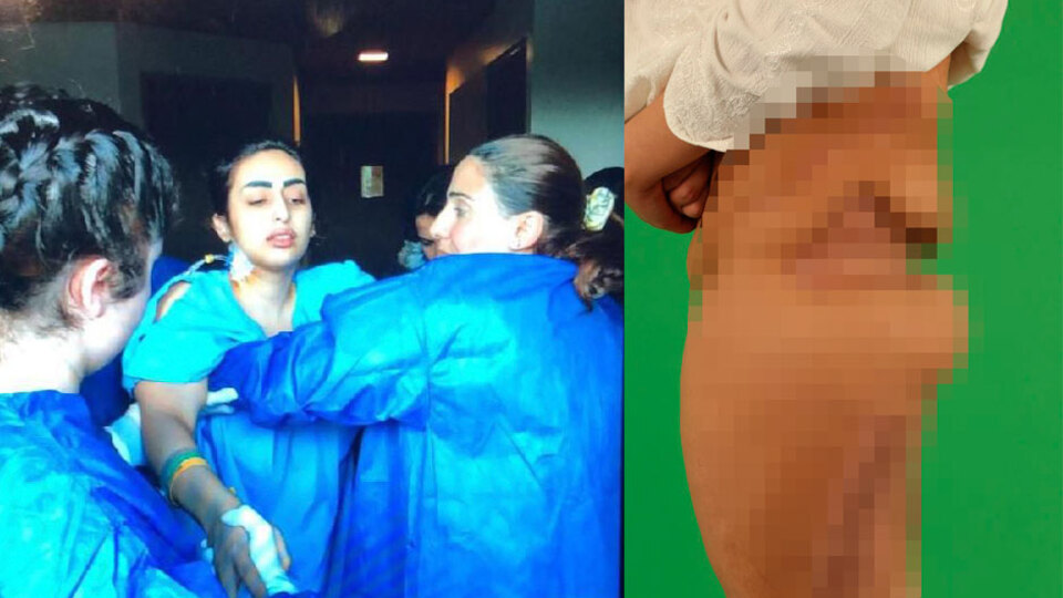 Çene estetiği olmak istedi, hayatı kabusa döndü!