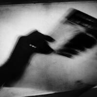 Verem 2017'de 1,3 milyon can aldı