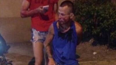 Kadın dövüşçü, gaspçıyı tanınmaz hale getirdi