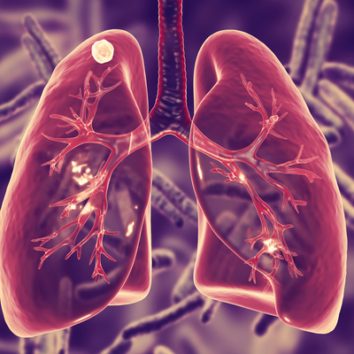 Dikkat! En çok öldüren 10 hastalıktan biri...