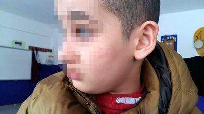 Öğretmenden otizmli öğrenciye dayak!