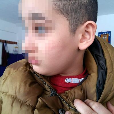 Öğretmenden otizmli öğrenciye dayak!