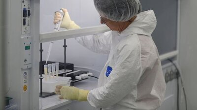 Kistik fibrozis tedavisinde 'ter testi kiti' hayati önem taşıyor