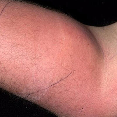 18 ay boyunca koluna sperm enjekte etmiş! İşte sebebi...