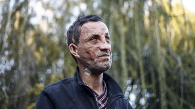 İşte Uğur Acar'ın son hali