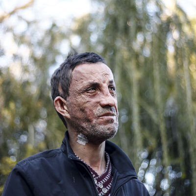 İşte Uğur Acar'ın son hali