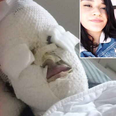 Yüzüne döktüğü sıvı montu eritti! Platonik aşık, bu hale getirdi!